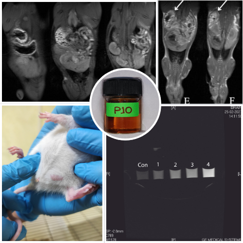 Applications of Xeuj MRI contrast agent